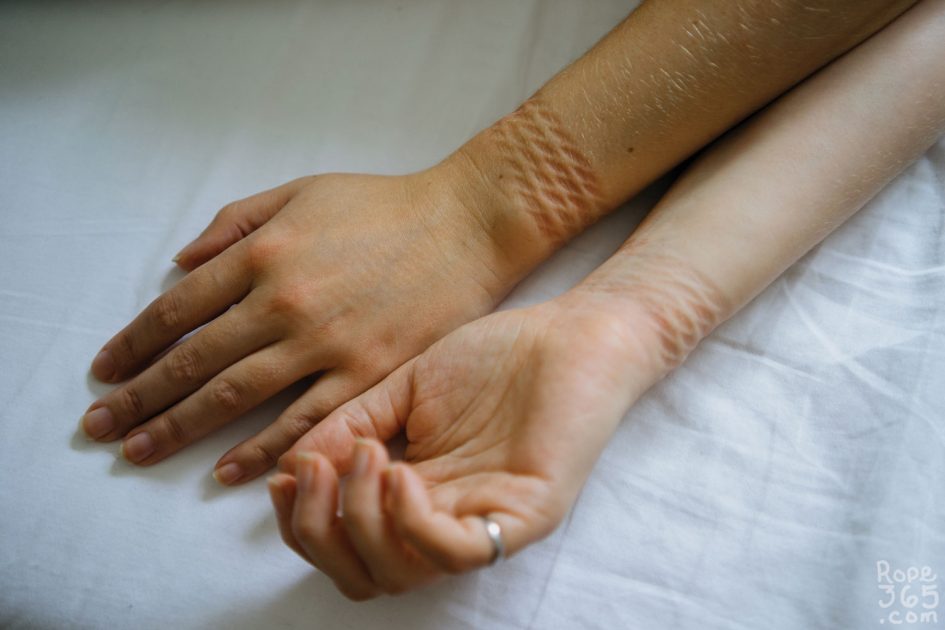 RopeMarksWrists Rope 365